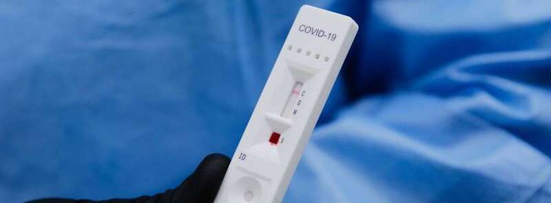 Prueba de la Covid-19/TA.